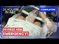 Paramedics Fight To Save Severed Arm 24 Hours In A E