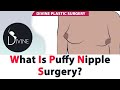 What Is Puffy Nipple Surgery Gynecomastia Surgery