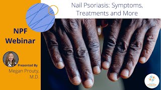Nail Psoriasis: Symptoms, Treatments and More