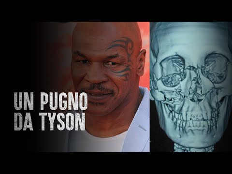 How to Survive a Mike Tyson Punch