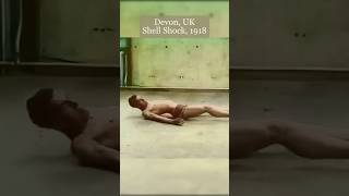 Download lagu WWI Soldier With Shell Shock Gets Help #colorized #history mp3 Download lagu WWI Soldier With Shell Shock Gets Help #colorized #history mp3