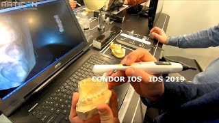 IDS 2019 - Стенд Condor: интраоральный сканнер Condor