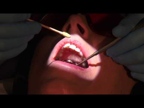 X-tip Anesthesia System - Dr. Scott Norton