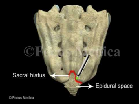 Caudal