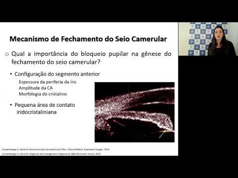 Aula -  Glaucoma de ângulo fechado
