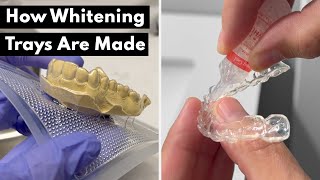 How Whitening Trays Are Made At The Dentist