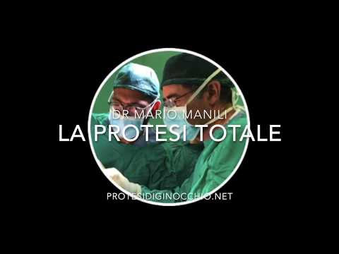 Artrite della diagnostica a raggi X dellanca Forte dolore nella parte bassa della schiena quando si sta seduti