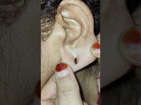 Invisible Earlobe Support Patches #earlobe #earlobepatches #earings #hack #trick #fashion #trending