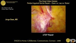 eTEP for inguinal hernia repair