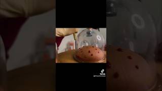 Download lagu Bekam Sunnah girls🥰 #bekam #spa #relaxing #asmr #kapasbeautyspa #tiktok mp3