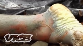 Tennessee&#39;s Farm of Rotting Corpses - Motherboard - VICE