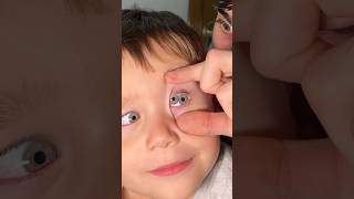 Mi Sobrino Robertito tiene 3 OJOS 👁️