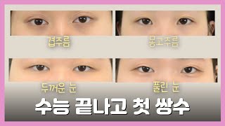 첫 쌍꺼풀 수술, 실패 없이 성공하려면?