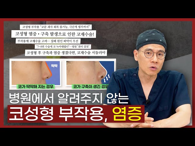 코성형과 얼굴형 잘하는 정우성형외과_코재수술ㅣ코재건_이물질 제거 코성형과 얼굴형 잘하는 정우성형외과_코재수술ㅣ코재건_이물질 제거