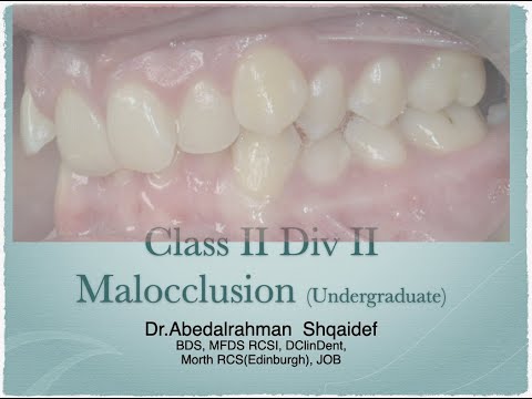 Class II div II (Undergraduate)