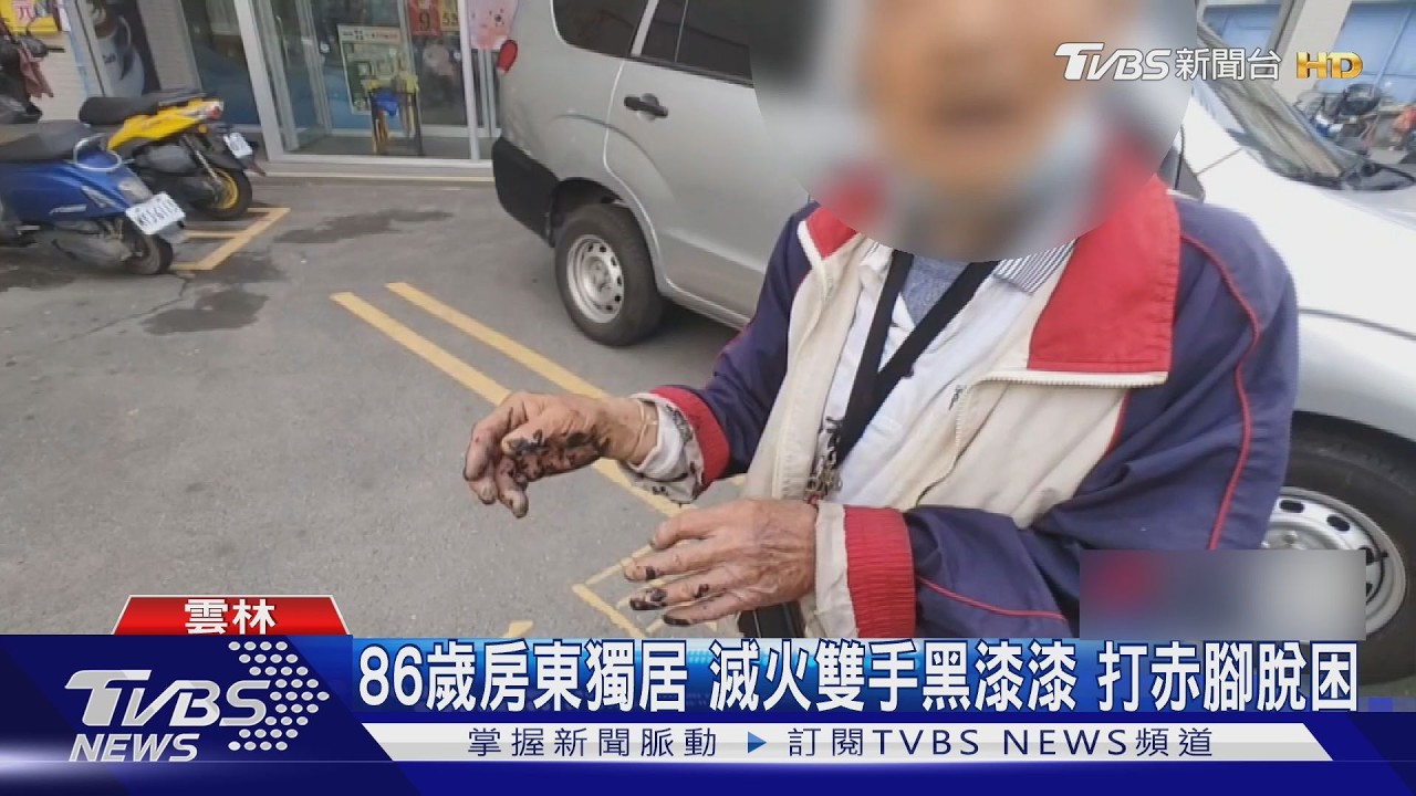電線走火!86歲獨居翁「腳踩滅火」鞋被黏住 赤腳逃出