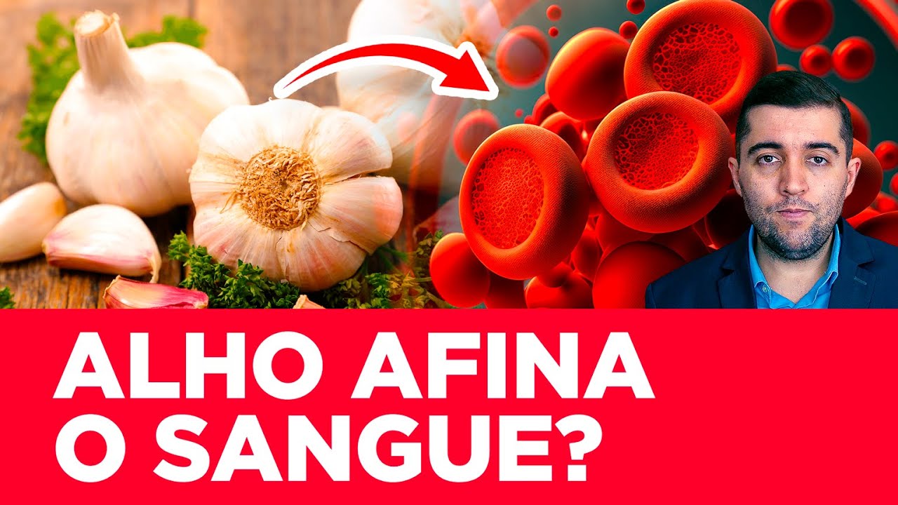 Alho: remédio natural para limpar coágulos do sangue e curar veias entupidas por trombose? Como usar