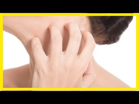 Wie kann man Juckreiz lindern?