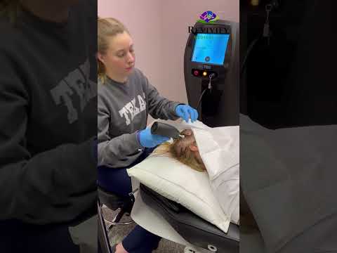 Alma TED Hair Restoration