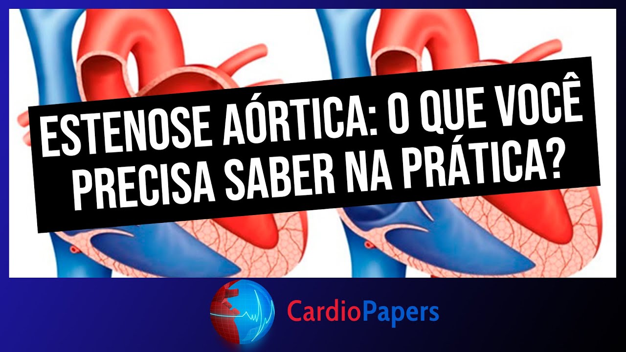 Estenose aórtica: o que você precisa saber na prática?