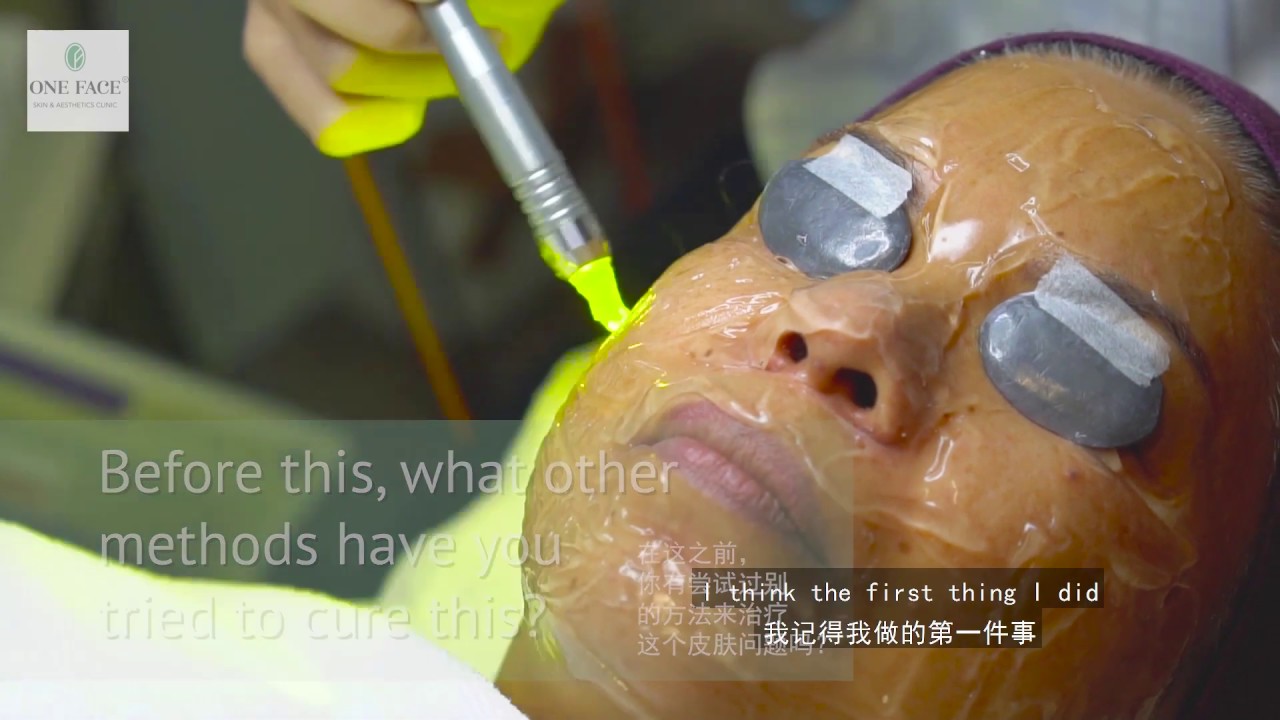 Mrs Low Shares Her Journey of Treating Melasma PIgmentation - Featuring Dr David Ng C H