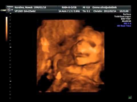 Leia Nowak i graviditetsvecka 23.