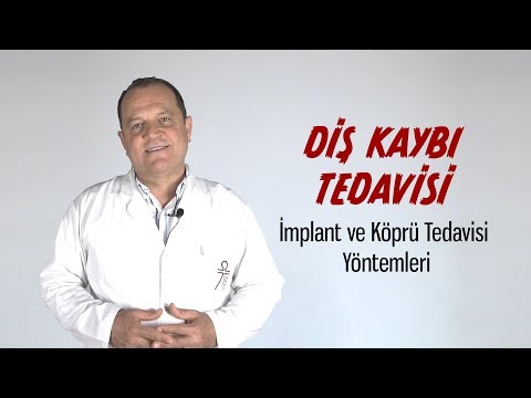 Diş Kaybı Tedavisi | İmplant ve Köprü Tedavisi