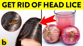 Home Remedies To Get Rid Of Head Lice