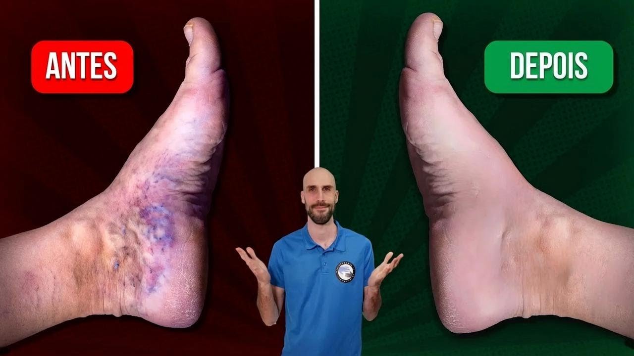 5 Exercícios para MELHORAR a CIRCULAÇÃO das pernas