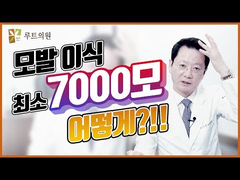심각한 탈모증 환자분에게 7000모를 심은 결과는?