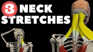 Download lagu Neck Stretches for Instant pain relief mp3 Download lagu Neck Stretches for Instant pain relief mp3