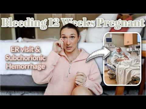 My Subchorionic Hematoma & Hemorrhage Experience | 1st & 2nd Trimester | Bleeding in Pregnancy