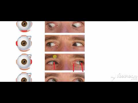 Extrinsic muscles action 1