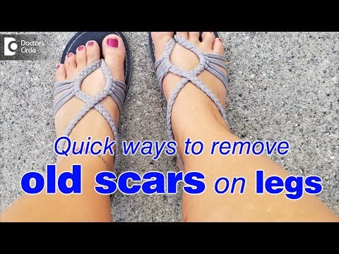 How to remove old scars on legs fast? - Dr. Rasya Dixit