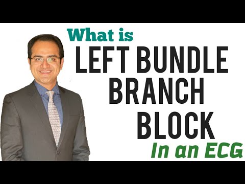 Left Bundle Branch Block (LBBB) ECG Made Easy, LBBB ECG Explained, ECG Lectures USMLE