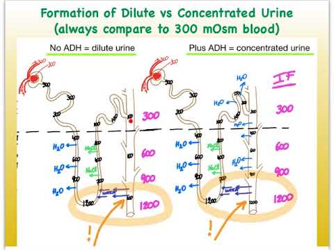 7O Urinary Dilute vs Concentrated Urine