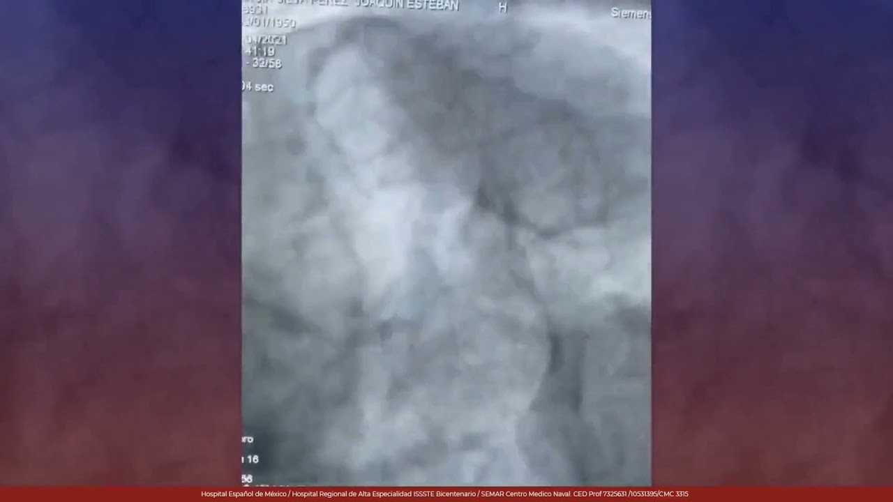 Marcelo Utrera Lagunas-108