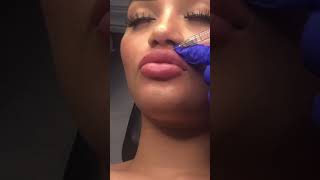 lip filling #beautiful #tiktok #shorts #fyp #tanisha#trending