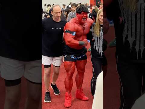 The hulk got a bad sunburn!