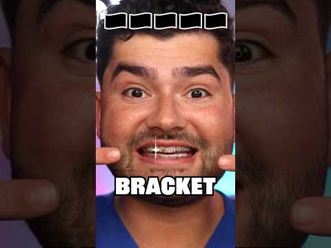 Which Country Snack is SAFE for Braces !?