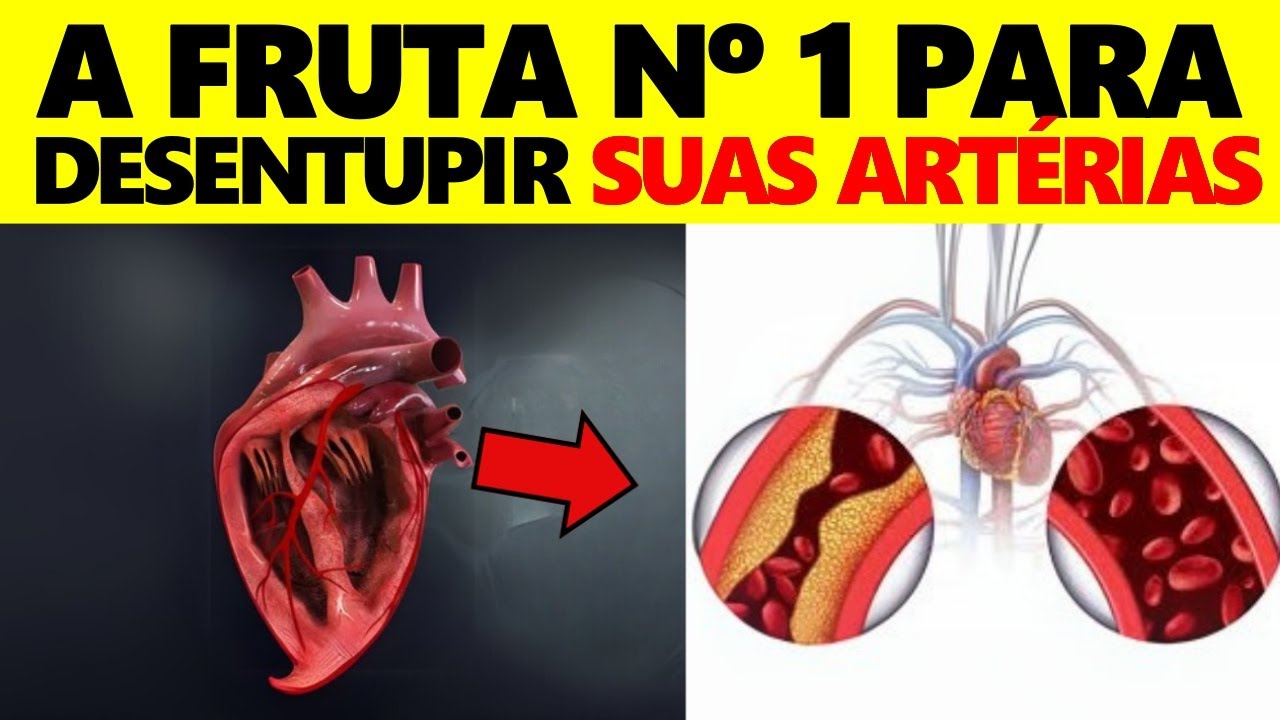 REVELADO! A FRUTA Nº 1 para desentupir suas artérias rapidamente!