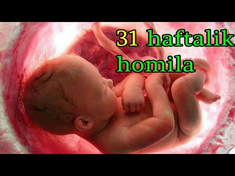 31 haftalik homila. Homiladorlikning 31- haftasi.
