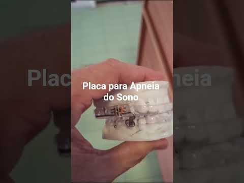 Anchieta Bessa-31