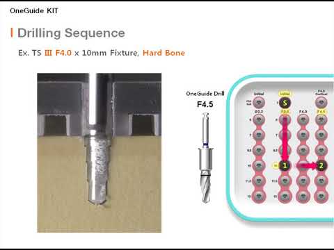 OneGuide KIT Drilling Sequence