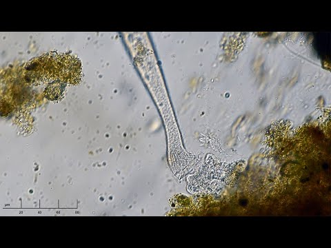 Cannibalistic Lacrymaria Eats Small Lacrymaria