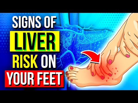 9 Secrets Your Feet Can Uncover About Your Liver Health