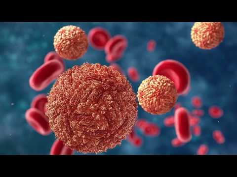 HITNO ELIMINIŠITE FAKTORE KOJI PODSTIČU RAK, SRČANE BOLESTI I MOŽDANI UDAR! Prof. dr Mihajlović