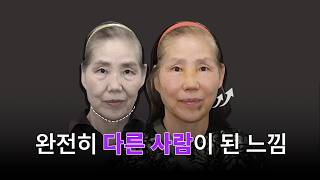 수술 이유가 분명해진 순간, 체감된 변화｜비중격만곡증 · 실 리프팅 리얼 후기
