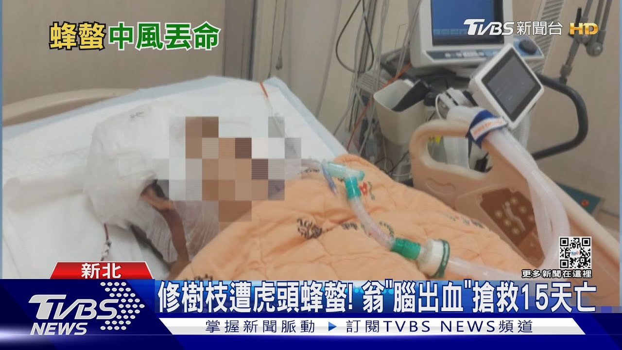 修樹枝遭虎頭蜂螫!翁「腦出血」搶救15天亡