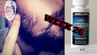 Minoxidil Beard | Week 26 | 6 Months!!! | The Experiment | #Facialfuzzfridays